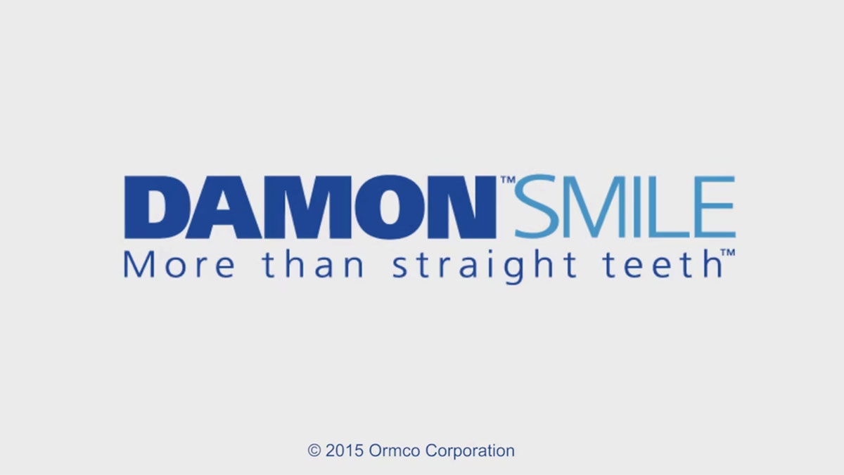 Damon Braces: Consultation